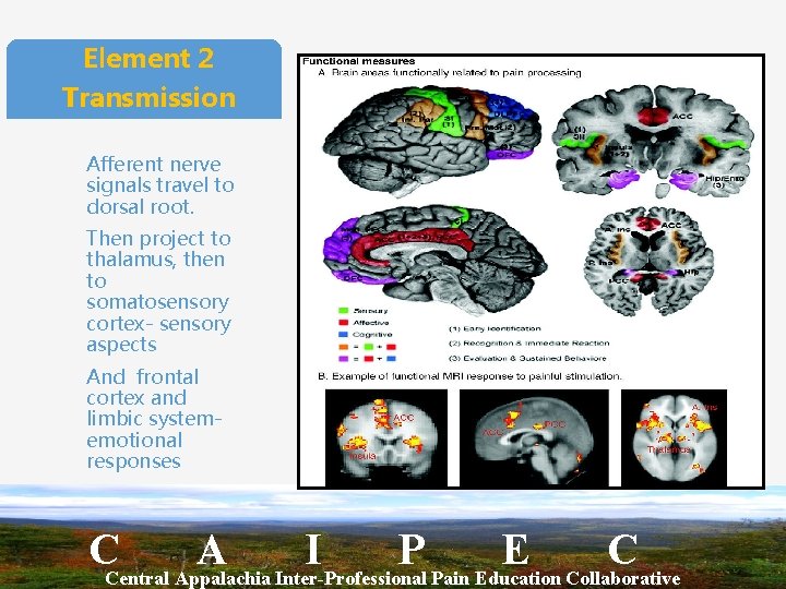 Element 2 Transmission Afferent nerve signals travel to dorsal root. Then project to thalamus,