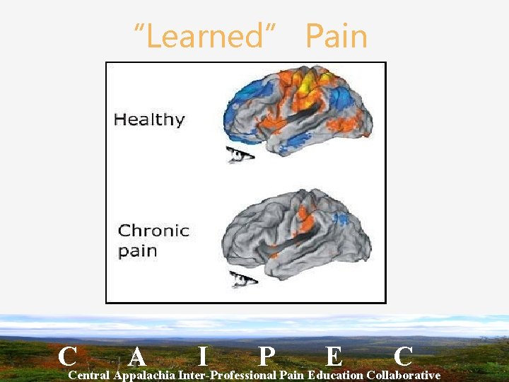“Learned” Pain CCentral Appalachia A Inter-Professional I P Pain Education E Collaborative C 