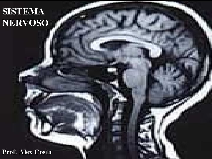 SISTEMA NERVOSO Prof. Alex Costa 