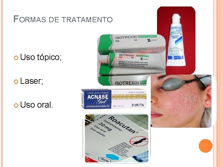 FORMAS DE TRATAMENTO Uso tópico; Laser; Uso oral. 