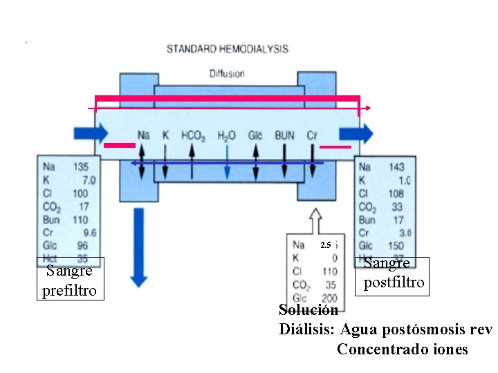 2. 5 Sangre prefiltro Sangre postfiltro Solución Diálisis: Agua postósmosis rev Concentrado iones 