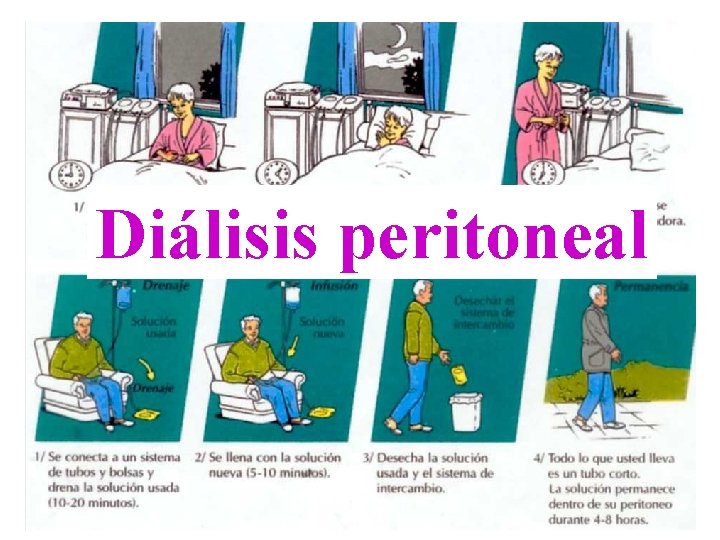 Diálisis peritoneal 