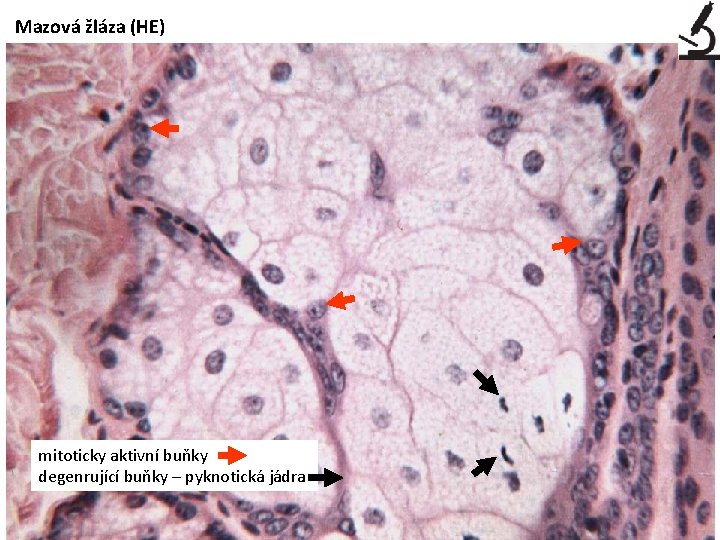 Mazová žláza (HE) mitoticky aktivní buňky degenrující buňky – pyknotická jádra 