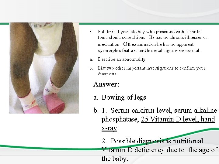  • Full term 1 year old boy who presented with afebrile tonic clonic