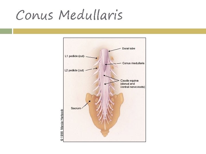 Conus Medullaris 