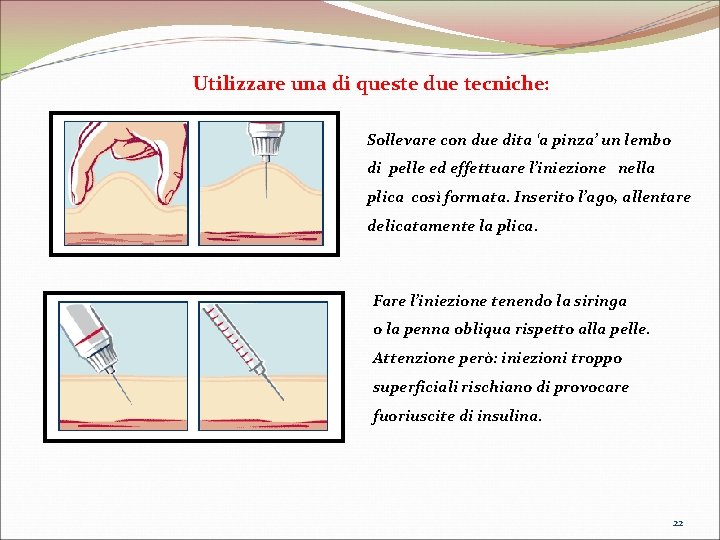 Utilizzare una di queste due tecniche: Sollevare con due dita ‘a pinza’ un lembo Utilizzare una di queste due tecniche: Sollevare con due dita ‘a pinza’ un lembo
