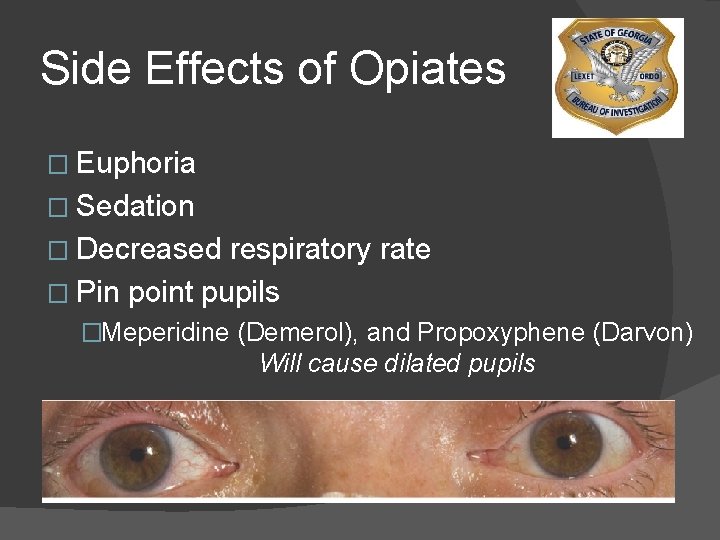 Side Effects of Opiates � Euphoria � Sedation � Decreased respiratory rate � Pin