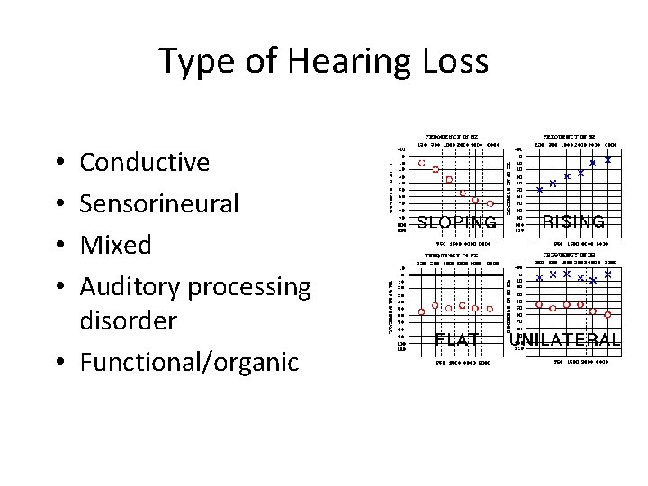 Type of Hearing Loss Conductive Sensorineural Mixed Auditory processing disorder • Functional/organic • •