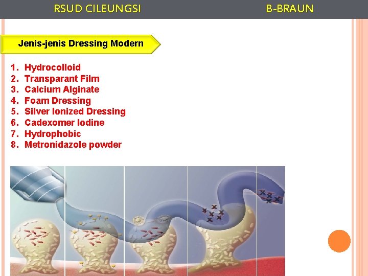 RSUD CILEUNGSI Jenis-jenis Dressing Modern 1. 2. 3. 4. 5. 6. 7. 8. Hydrocolloid