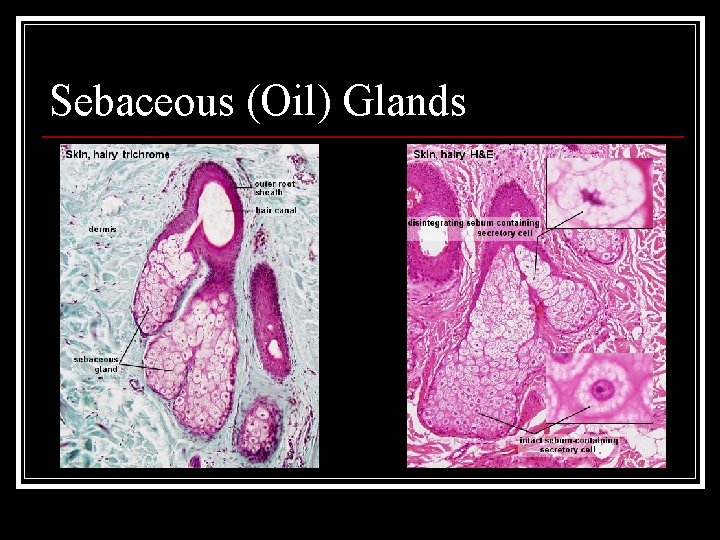 Sebaceous (Oil) Glands 
