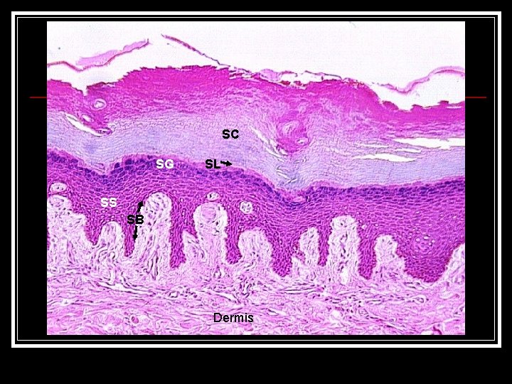 SC SG SL SS SB Dermis 