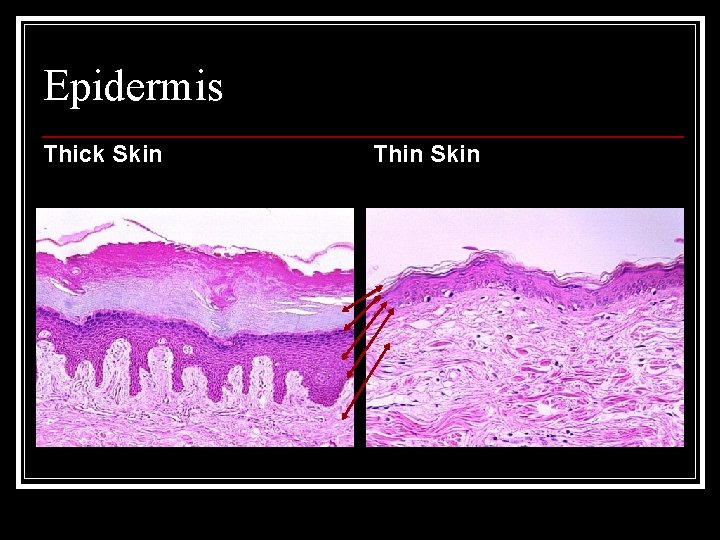 Epidermis Thick Skin Thin Skin 