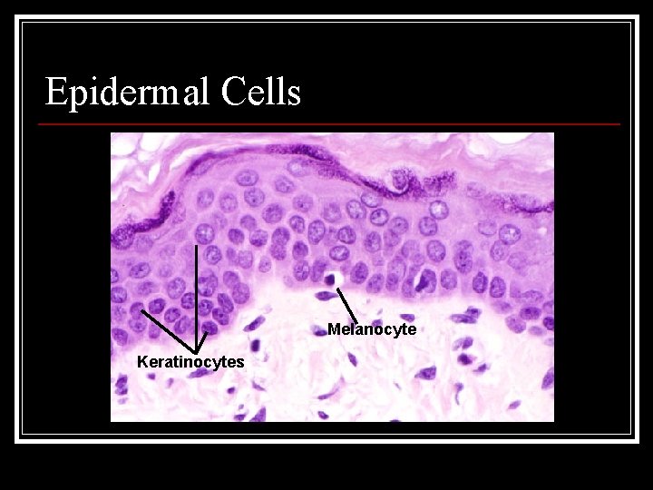 Epidermal Cells Melanocyte Keratinocytes 