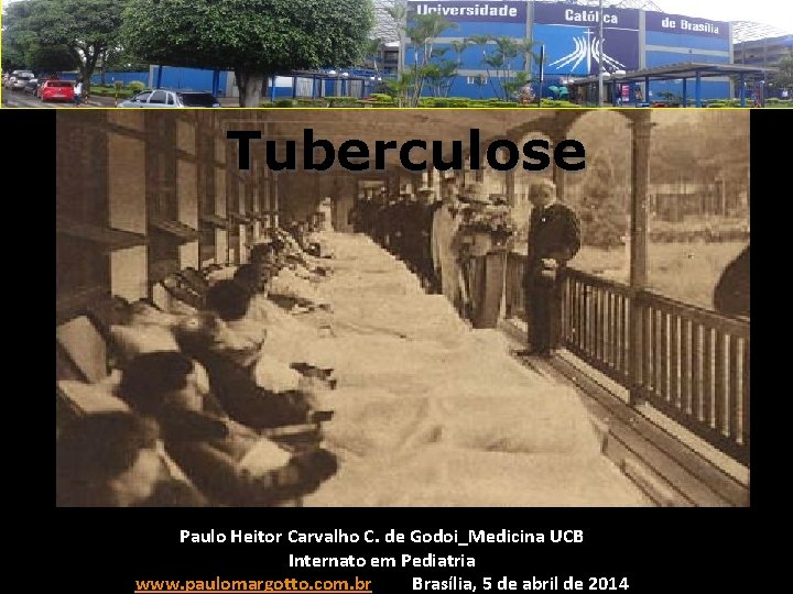 Tuberculose Paulo Heitor Carvalho C. de Godoi_Medicina UCB Internato em Pediatria www. paulomargotto. com.