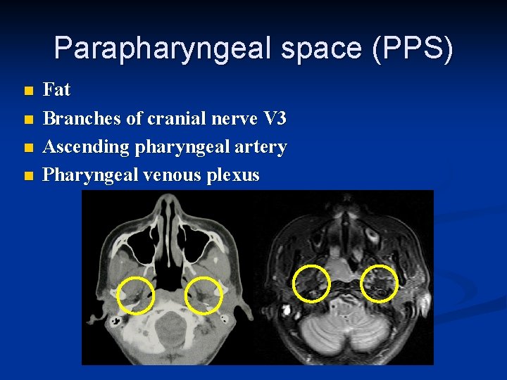 Parapharyngeal space (PPS) n n Fat Branches of cranial nerve V 3 Ascending pharyngeal