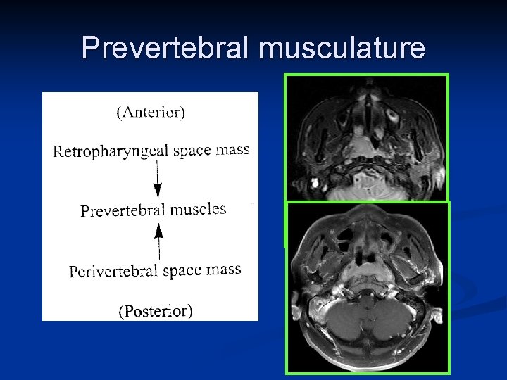 Prevertebral musculature 