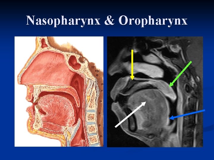 Nasopharynx & Oropharynx 