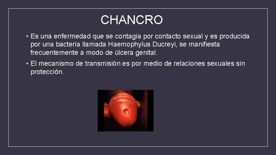 CHANCRO • Es una enfermedad que se contagia por contacto sexual y es producida