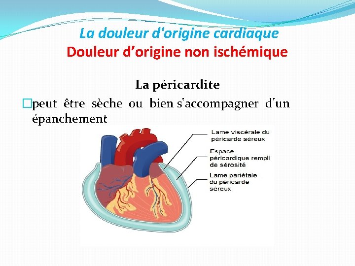 La douleur d'origine cardiaque Douleur d’origine non ischémique La péricardite �peut être sèche ou