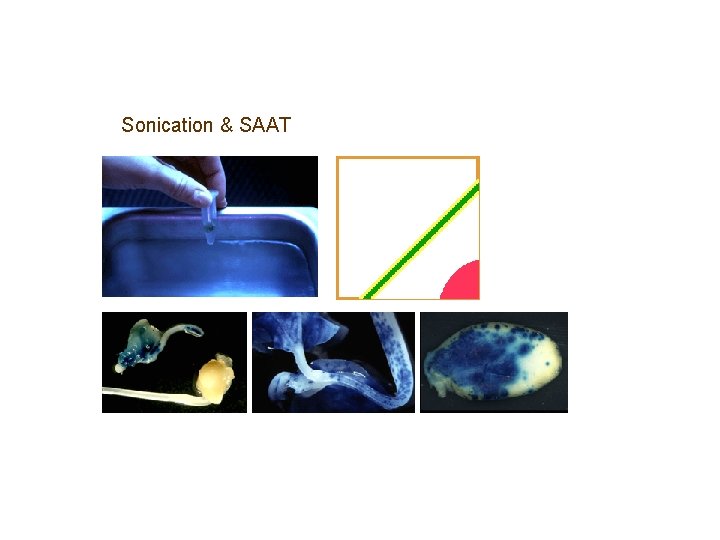 Sonication & SAAT Sonication & SAAT