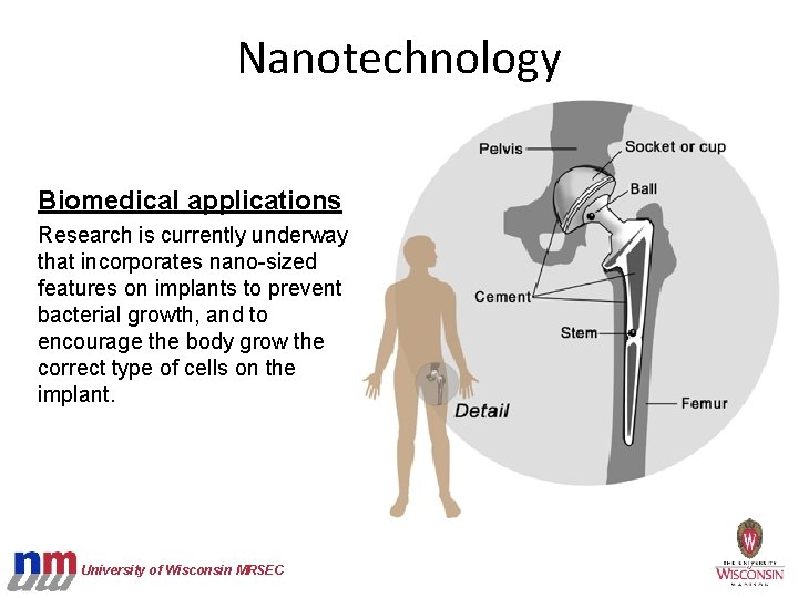 Nanotechnology Biomedical applications Research is currently underway that incorporates nano-sized features on implants to