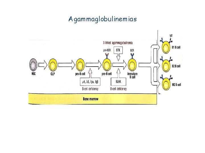 Agammaglobulinemias 