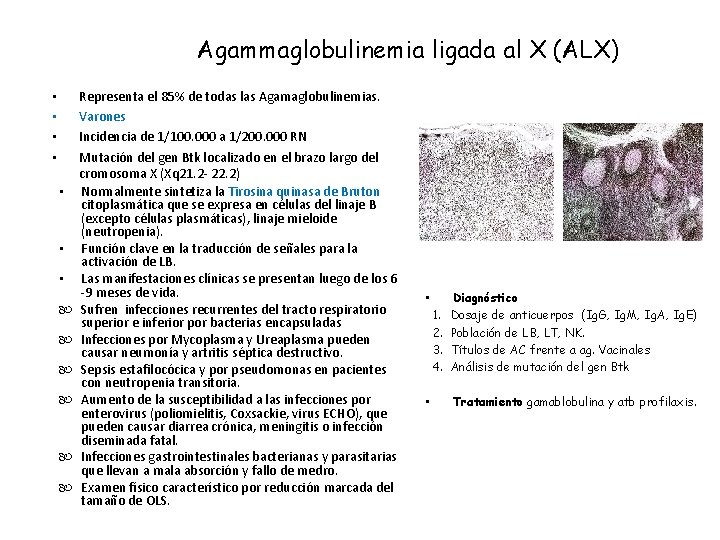 Agammaglobulinemia ligada al X (ALX) • • Representa el 85% de todas las Agamaglobulinemias.