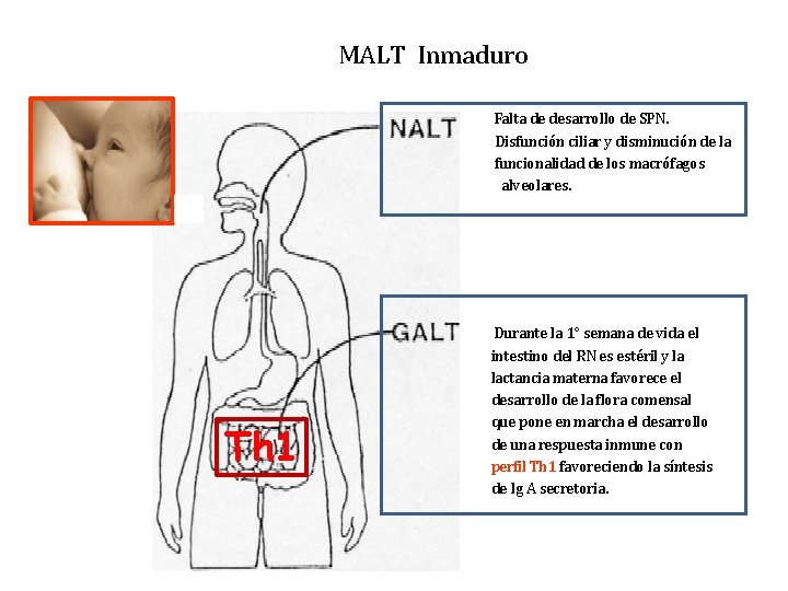 MALT Inmaduro Falta de desarrollo de SPN. Disfunción ciliar y disminución de la funcionalidad