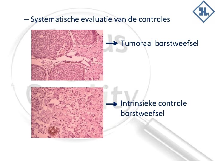 – Systematische evaluatie van de controles Tumoraal borstweefsel Intrinsieke controle borstweefsel 
