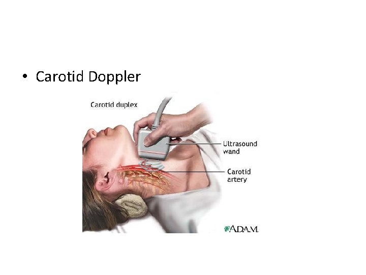  • Carotid Doppler 