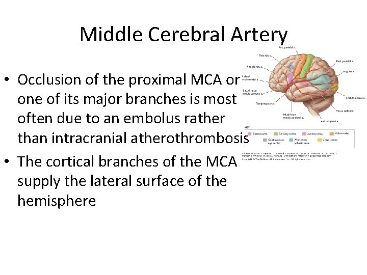 Middle Cerebral Artery • Occlusion of the proximal MCA or one of its major