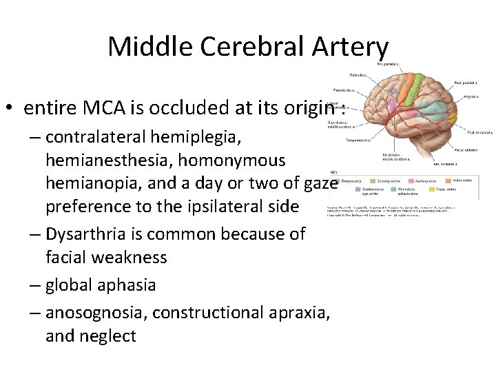 Middle Cerebral Artery • entire MCA is occluded at its origin : – contralateral