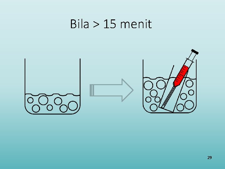 Bila > 15 menit 29 