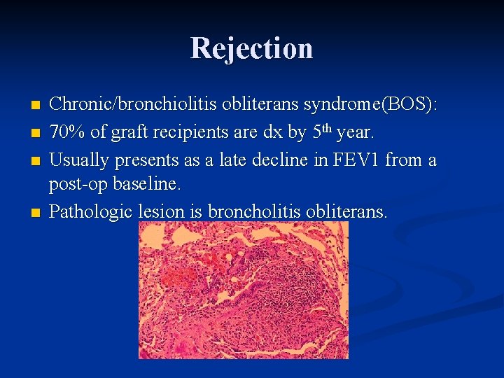 Rejection n n Chronic/bronchiolitis obliterans syndrome(BOS): 70% of graft recipients are dx by 5