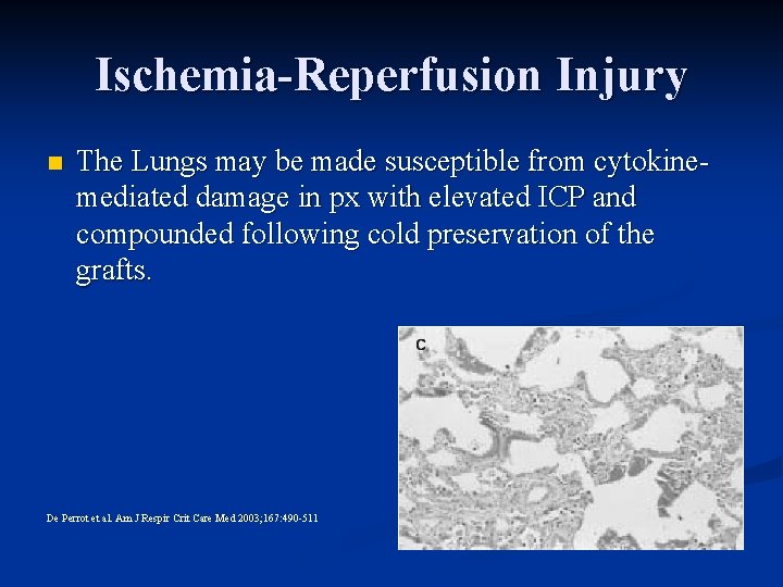 Ischemia-Reperfusion Injury n The Lungs may be made susceptible from cytokinemediated damage in px