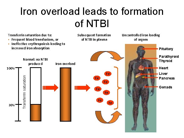 Iron overload leads to formation of NTBI Transferrin saturation due to: • Frequent blood