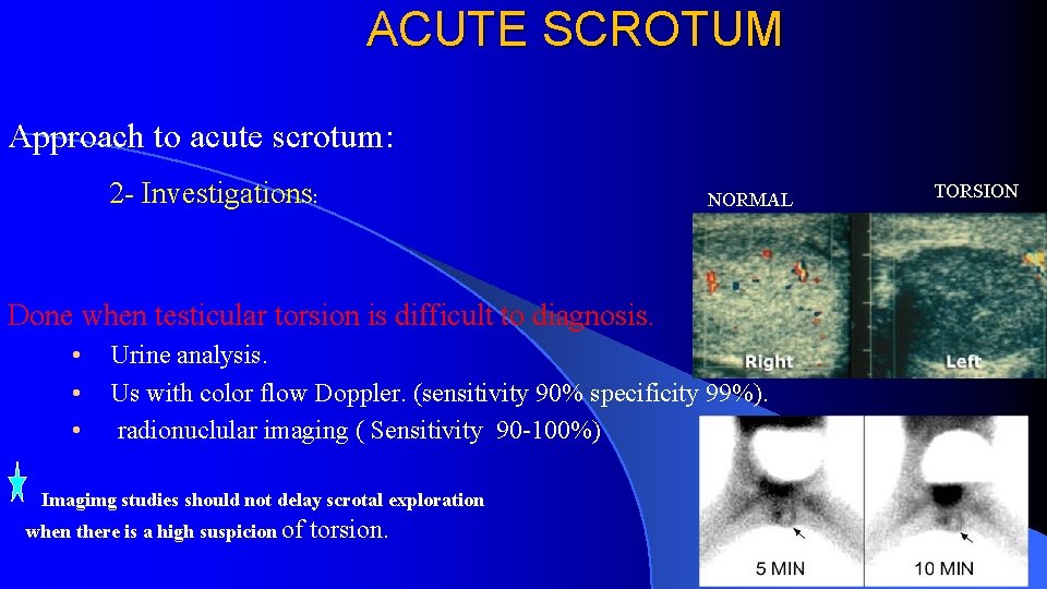 ACUTE SCROTUM Approach to acute scrotum: 2 - Investigations: NORMAL Done when testicular torsion