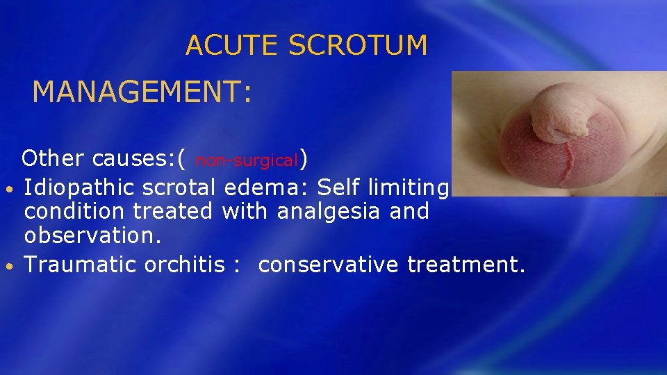 ACUTE SCROTUM MANAGEMENT: Other causes: ( non-surgical) • Idiopathic scrotal edema: Self limiting condition