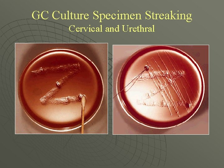 GC Culture Specimen Streaking Cervical and Urethral 