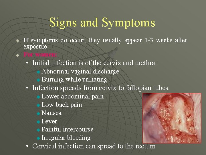 Signs and Symptoms u u If symptoms do occur, they usually appear 1 -3