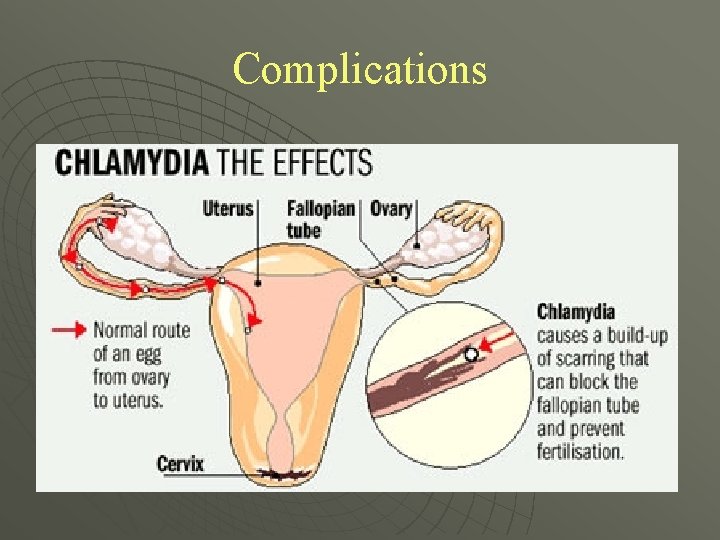 Complications 