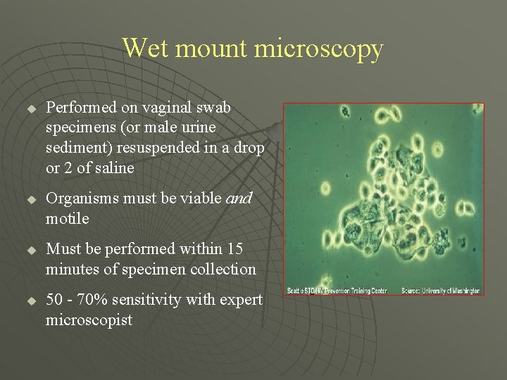Wet mount microscopy u u Performed on vaginal swab specimens (or male urine sediment)