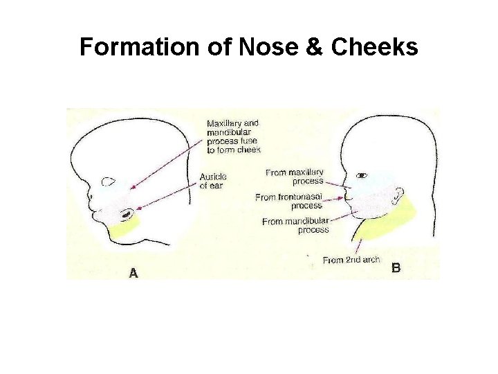 Formation of Nose & Cheeks 
