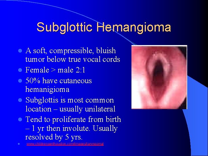 Subglottic Hemangioma l l l A soft, compressible, bluish tumor below true vocal cords