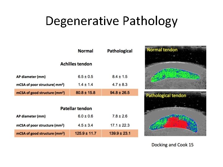 Degenerative Pathology 