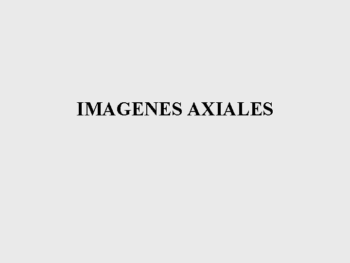 IMAGENES AXIALES 