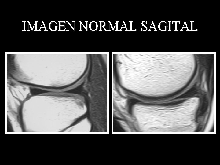 IMAGEN NORMAL SAGITAL 