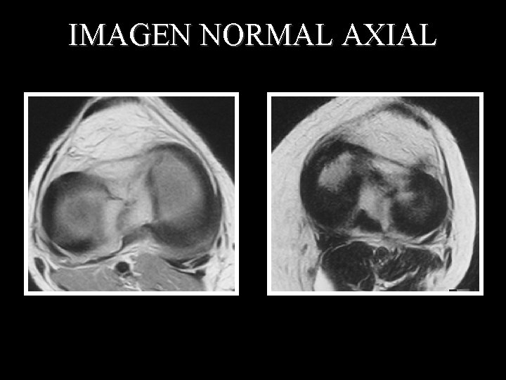 IMAGEN NORMAL AXIAL IMAGEN NORMAL AXIAL