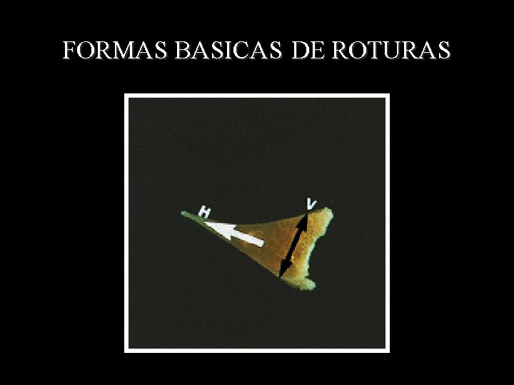 FORMAS BASICAS DE ROTURAS 