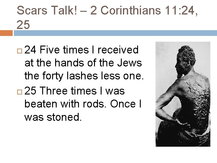 Scars Talk! – 2 Corinthians 11: 24, 25 24 Five times I received at Scars Talk! – 2 Corinthians 11: 24, 25 24 Five times I received at